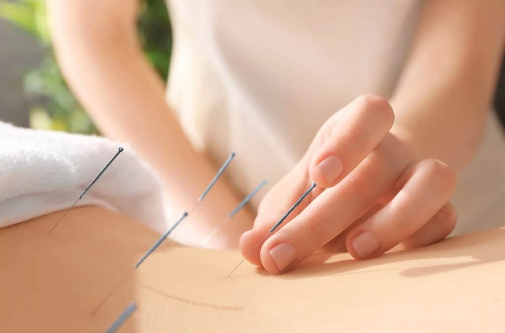 Back Acupuncture