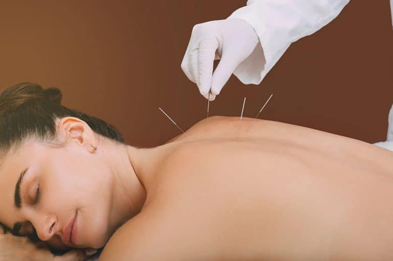 Does Back Acupuncture Work for Back Pain?